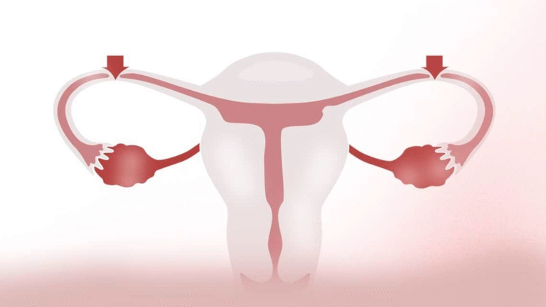 Achieving Pregnancy After Tubal Reversal in Oklahoma Midwest Fertility Center