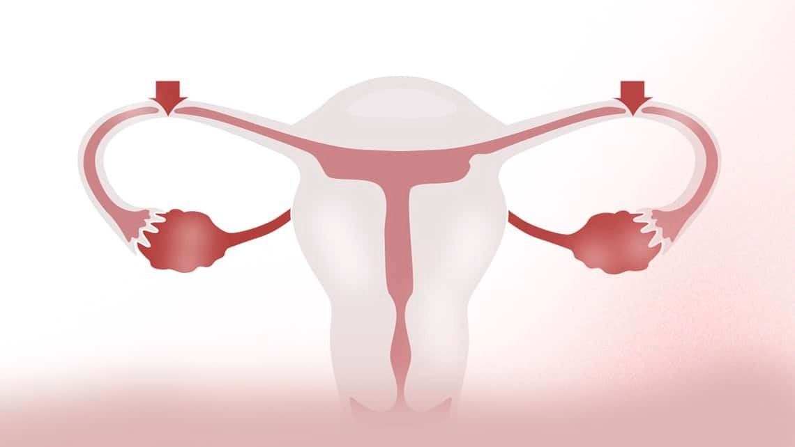 Achieving Pregnancy After Tubal Reversal in Oklahoma Midwest Fertility Center