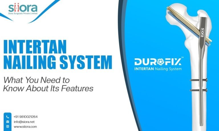 Intertan Nailing System: What You Need to Know About Its Features